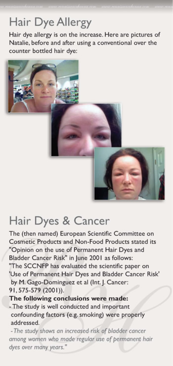 PPD/ Hair Dye Allergy | Renaissance Henna