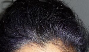 Purple Hairline Strands in Gray Hair with Indigo