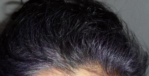 Grey Hairline coloured purple with indigo