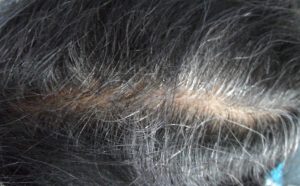 Gray Roots in Black hair