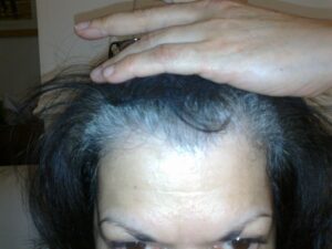 Grey hair on white skin before natural henna and indigo hair colour treatment