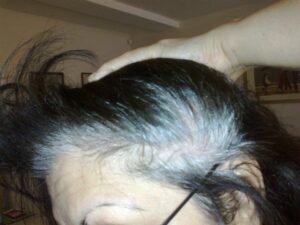 Customer 1 showing side view of natural grey hair before using Renaissance Henna and Indigo