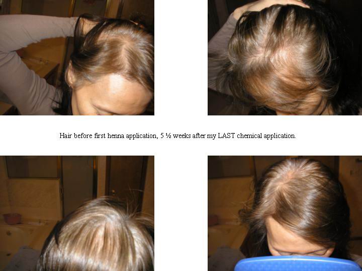 Celine's grey hair before henna, showing regrowth and chemical dye fading in four close-up views.