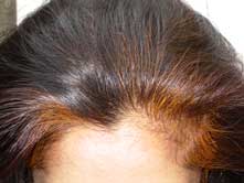 Maryam hennaed hair, forehead view